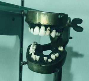 Image of teeth in a vice